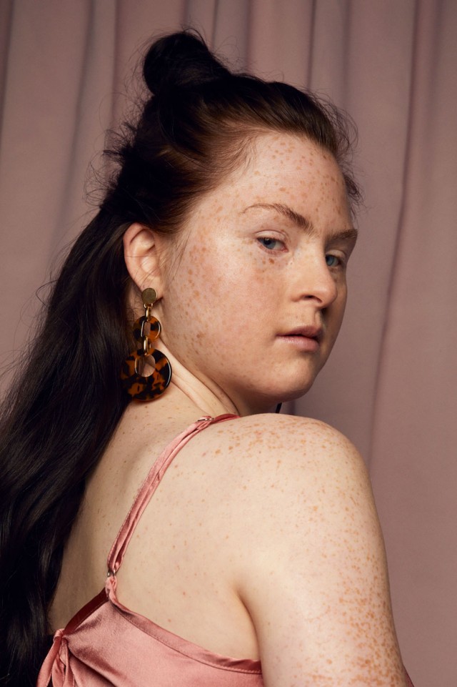 Cosmopola - Frauke Fischer - Beauty is in Everyone. Everyone is Beautiful. Being Different is Beautiful. ELLE Bulgaria Magazine